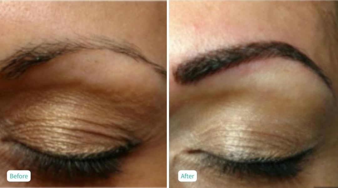 Permanent Make UP - Case 2