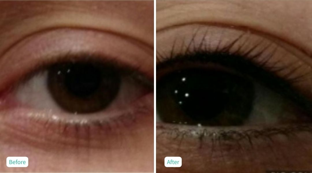 Permanent Make UP - Case 3