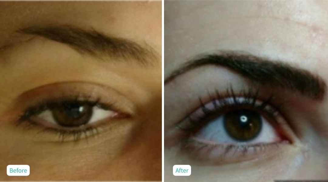 Permanent Make UP - Case 4