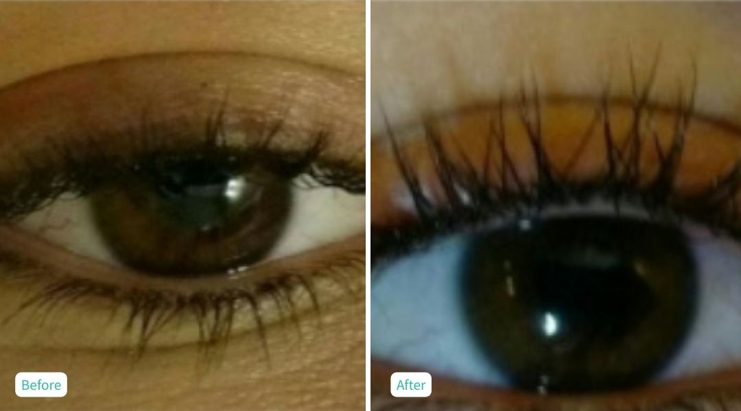 Permanent Make UP - Case 6
