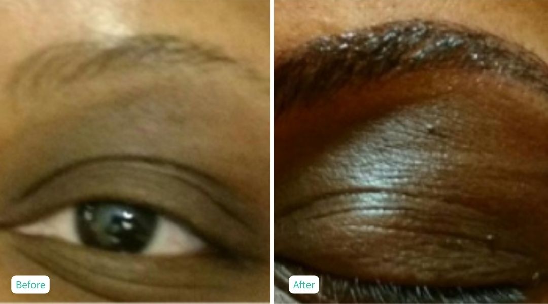 Permanent Make UP - Case 7