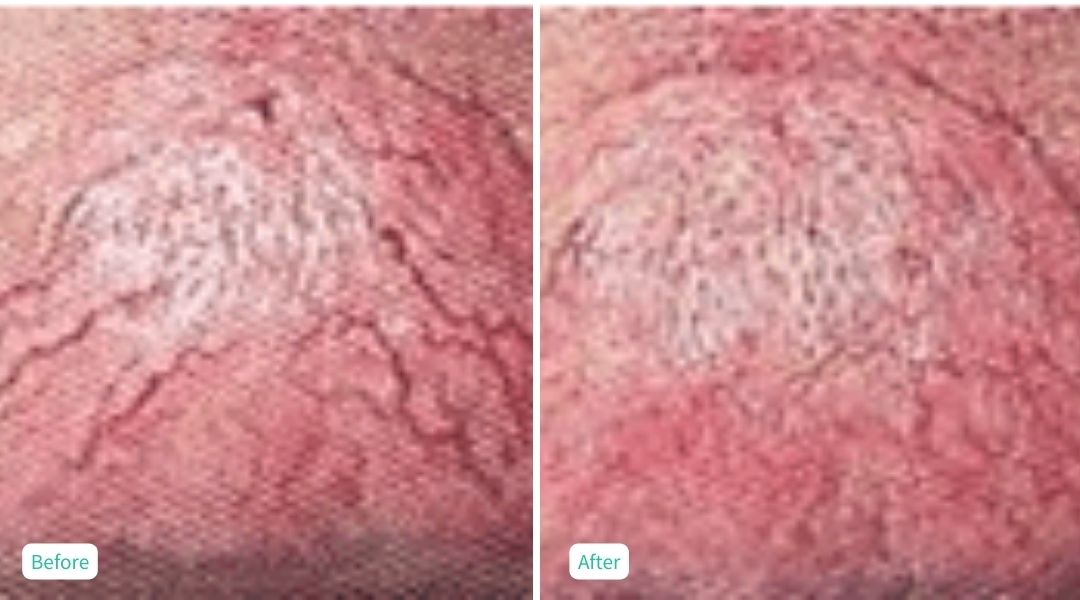 Skin Issues - Case 1