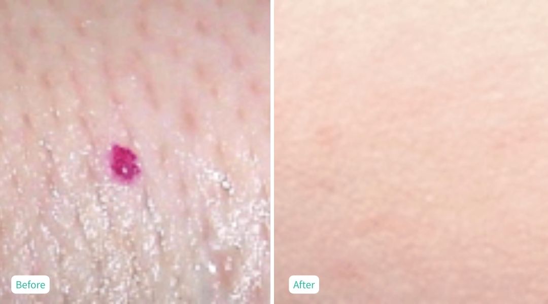 Skin Issues - Case 6