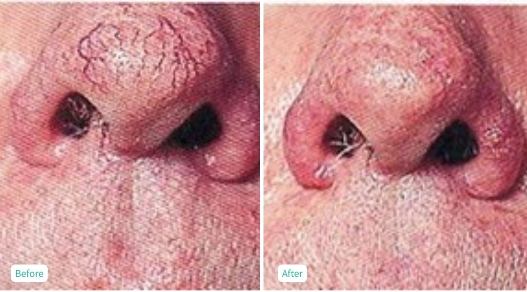 Skin Issues - Case 3